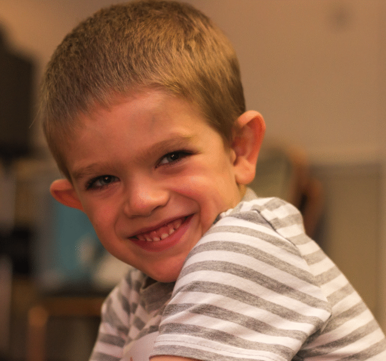 Fragile X Syndrome across the lifespan