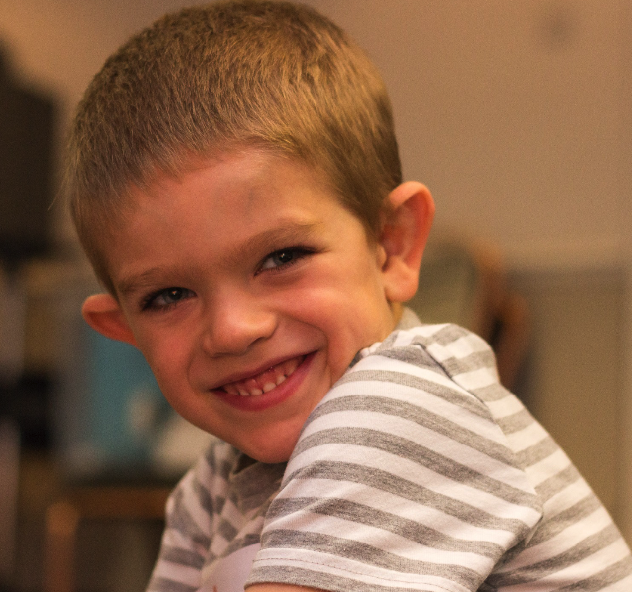 Fragile X Syndrome across the lifespan