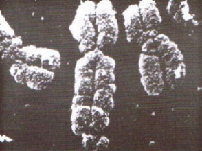 A photo of a fragile X chromosome under a microscope
